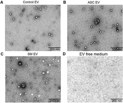 Macrophage-derived extracellular vesicles from Ascaris lumbricoides antigen exposure enhance Mycobacterium tuberculosis growth control, reduce IL-1β, and contain miR-342-5p, miR-516b-5p, and miR-570-3p that regulate PI3K/AKT and MAPK signaling pathways